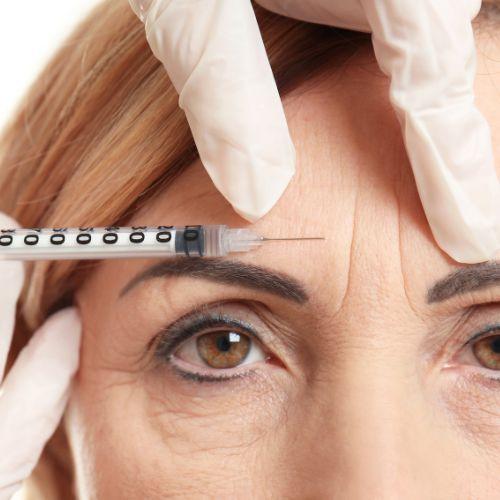 Wrinkle (Botox) Treatment
