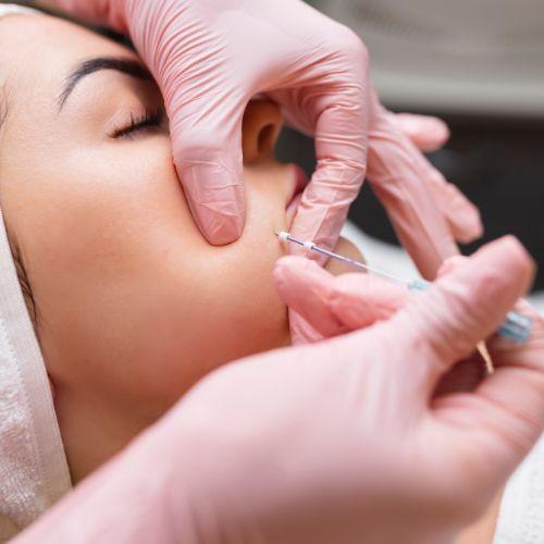 Dermal Fillers