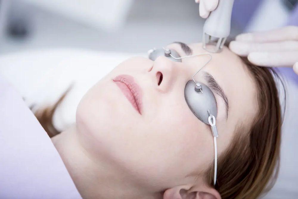 Fractional CO2 Laser