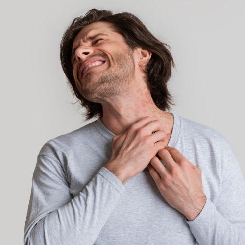 Fungal Infection Treatment