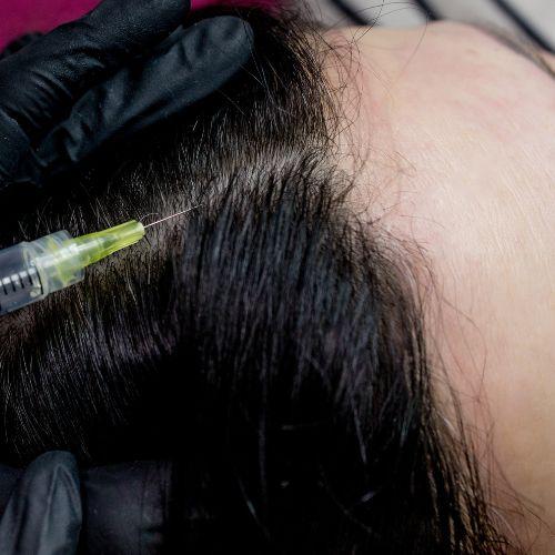 GFC Hair Treatment
