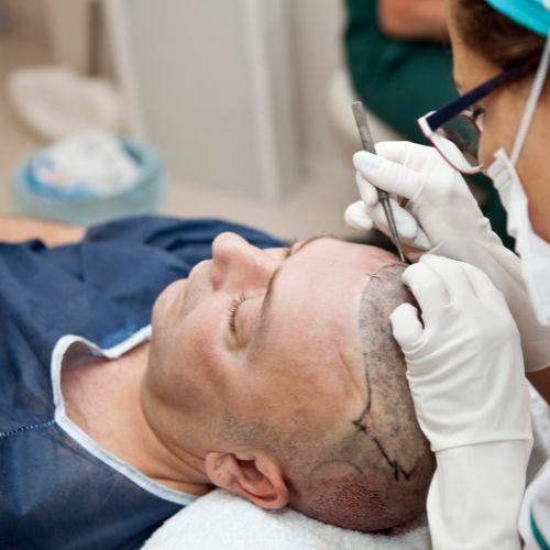 Hair Transplantation