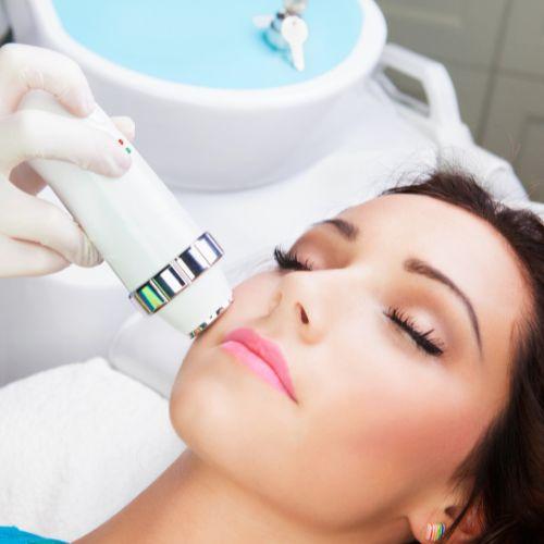 Laser for Acne Scars