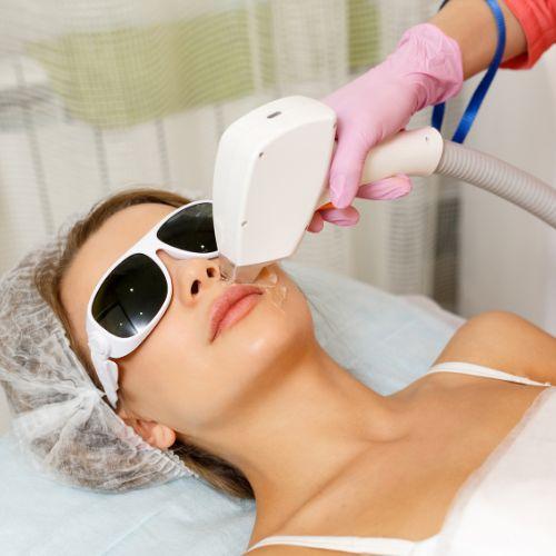 Laser Hair Reduction