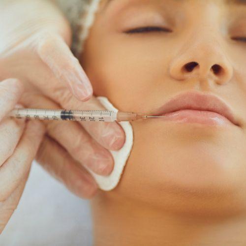 Profhilo / Hyaluronic Acid Injection