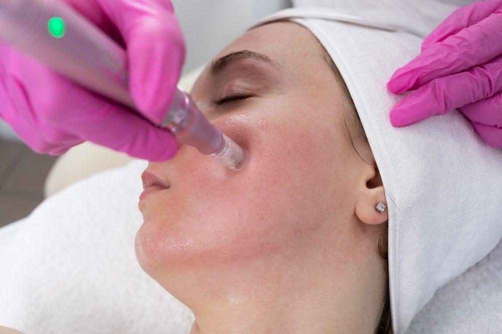 PRP + MNRF for Skin