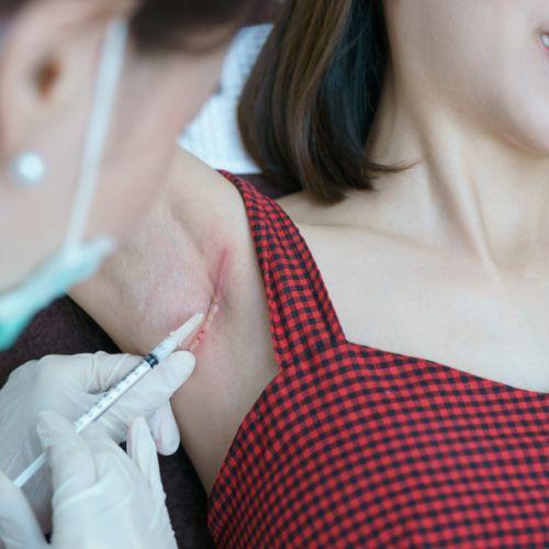 Skin PRP Treatment