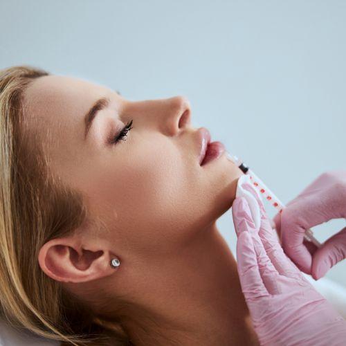 Thread Lift