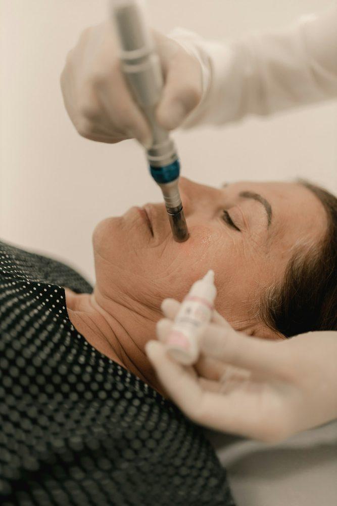 Vampire Facial