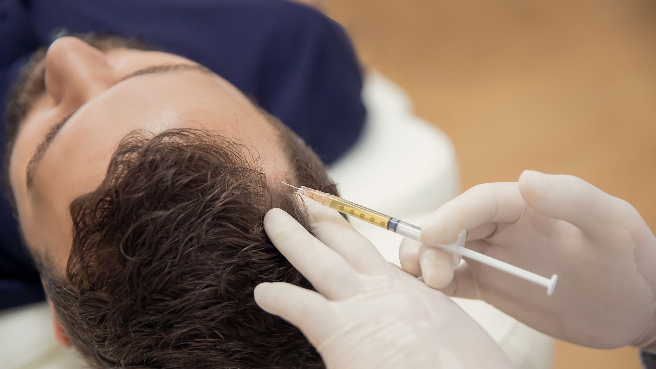 Unlocking the Power of PRP and GFC for Hair Restoration: A Comprehensive Guide by Nishka Skin Clinic