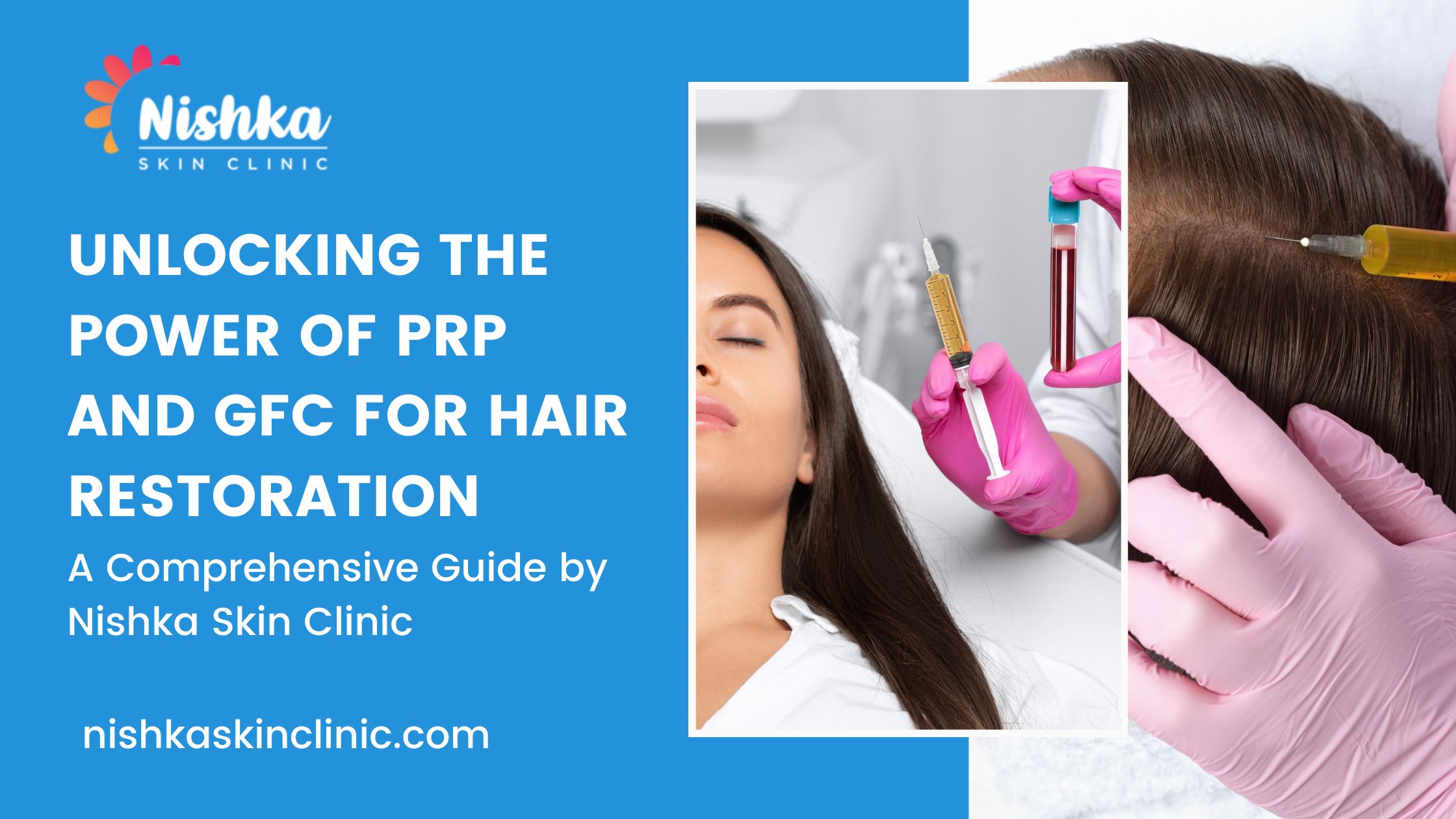 PRP and GFC for Hair Restoration